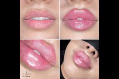 Velvet Aesthetics Nuneaton