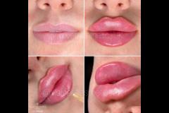 Velvet Aesthetics Nuneaton - 6