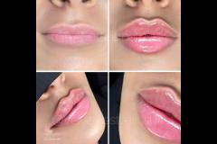 Velvet Aesthetics Nuneaton - 7