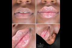 Velvet Aesthetics Nuneaton - 10