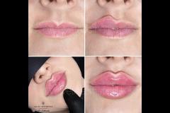 Velvet Aesthetics Nuneaton - 11