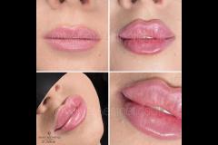 Velvet Aesthetics Nuneaton - 15