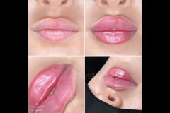 Velvet Aesthetics Nuneaton - 16