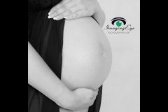 Imaging Eye Photography