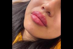 Definition Aesthetics & Beauty Nuneaton - 15