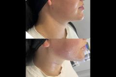 House of Glow Worcester - 7