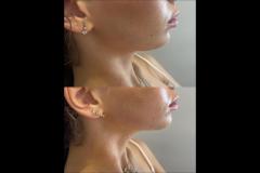 House of Glow Worcester - 8