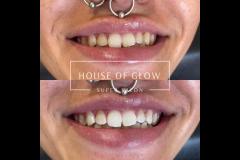 House of Glow Worcester - 10