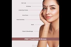 Apsaras Aesthetic Clinic Coventry