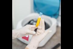 Apsaras Aesthetic Clinic Coventry - 11